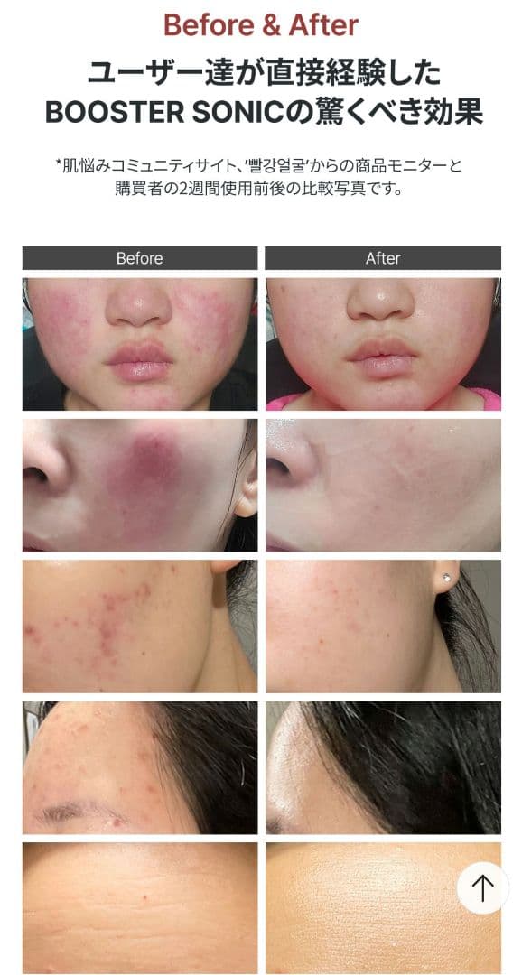 新品同様箱付☆Glow.M Booster Sonic 美容機器