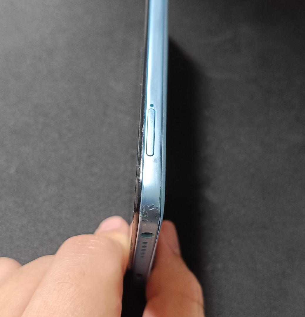 Xiaomi Redmi Note 11 本体