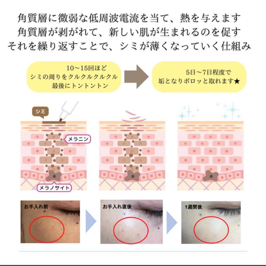 低周波ペンシル　シミケア機　リシルク　ReSilk セット販売