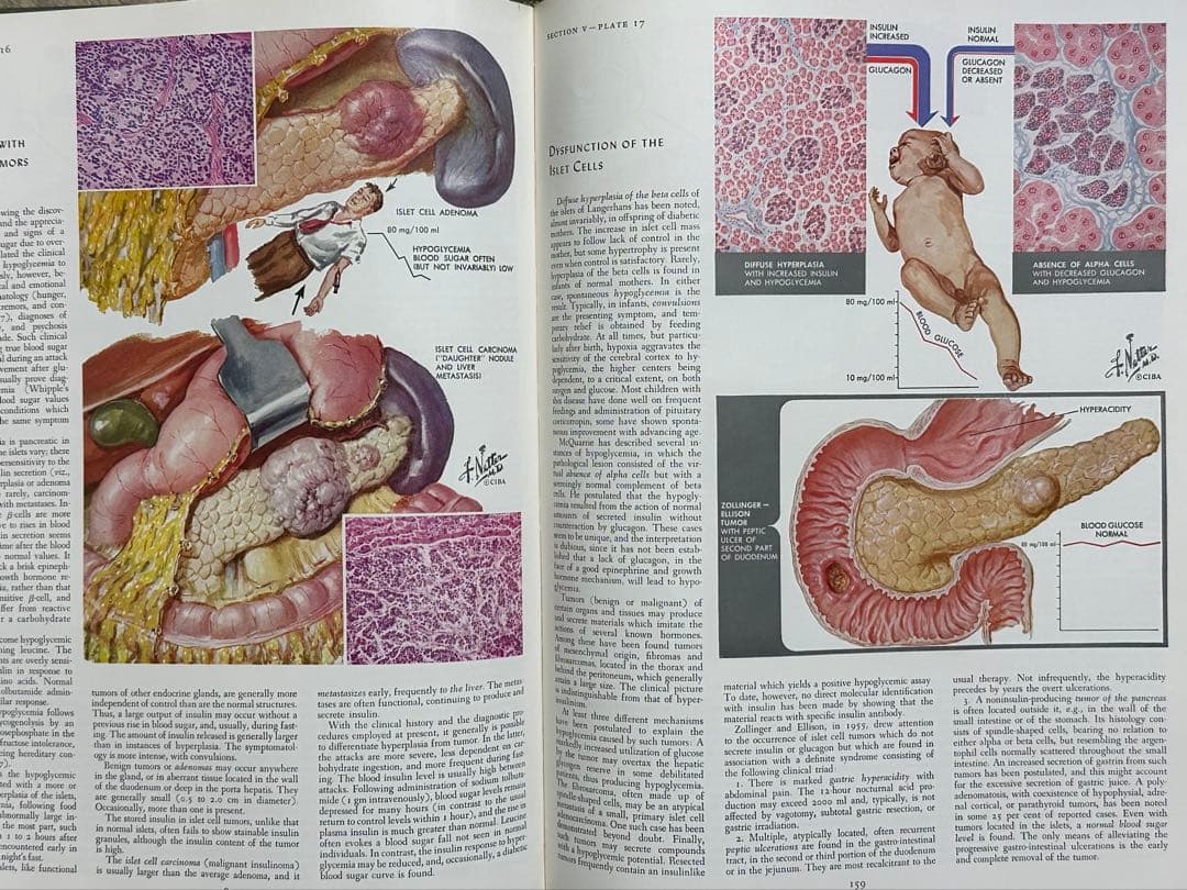 CIBA医学イラスト集 1、2、3(1-2-3)、4、5 /フランクH.ネッター