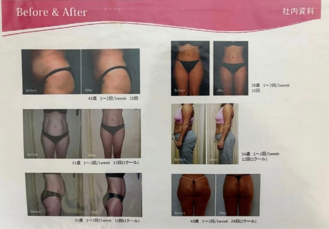 大手エステサロン導入品　業務用　キャビコンパクト　朝まで価格