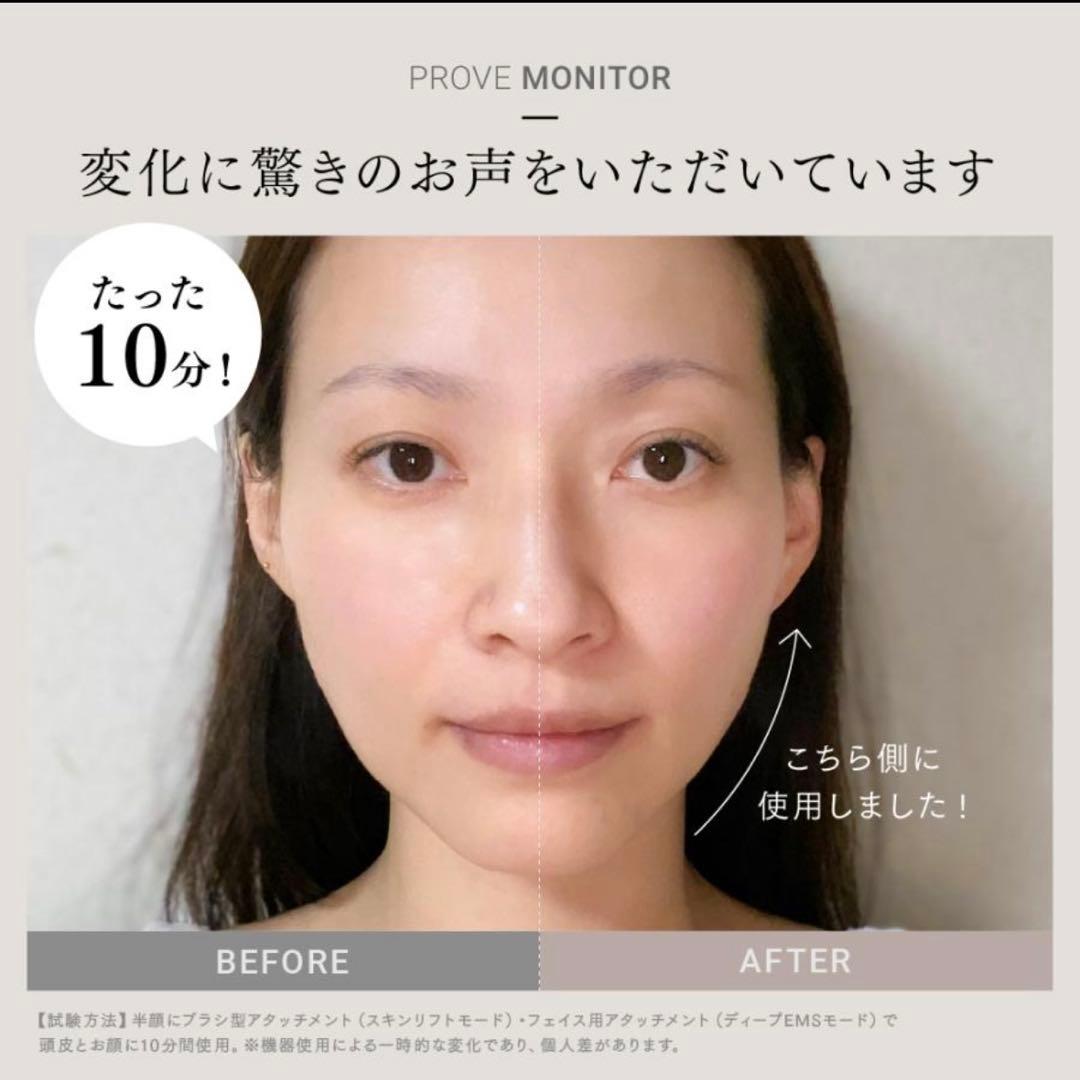 MYTREX 美顔器 ヘアブラシ型