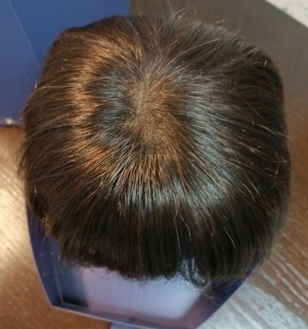 フォンテーヌ トップピース