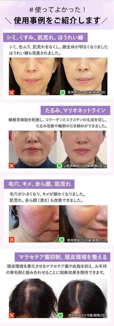 DENSINDO プラズマエアシャワー美顔器 Un-アン