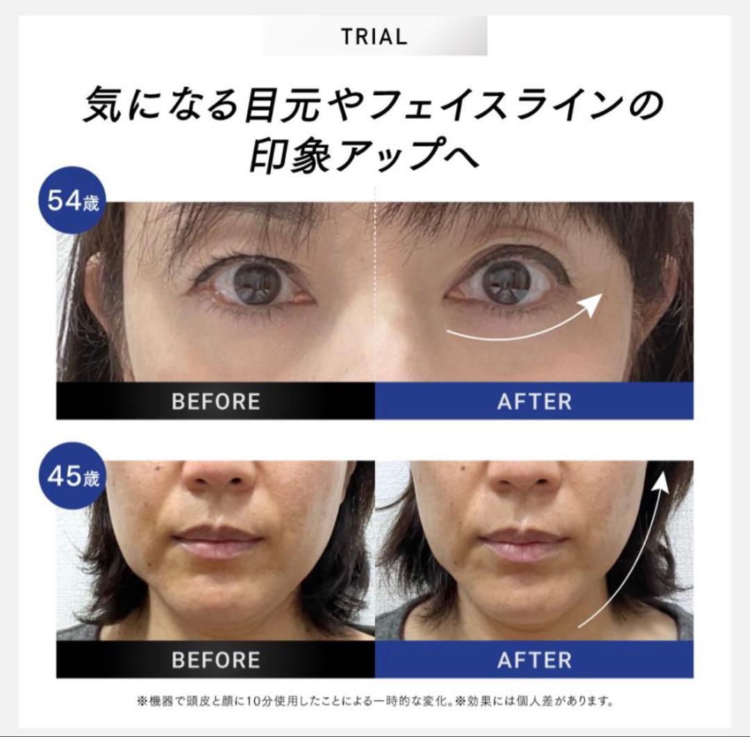 ☆新品未開封☆MYTREX PROVE CORE 美容器セット