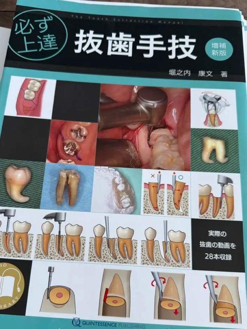 必ず上達 抜歯手技 増補新版　裁断済み