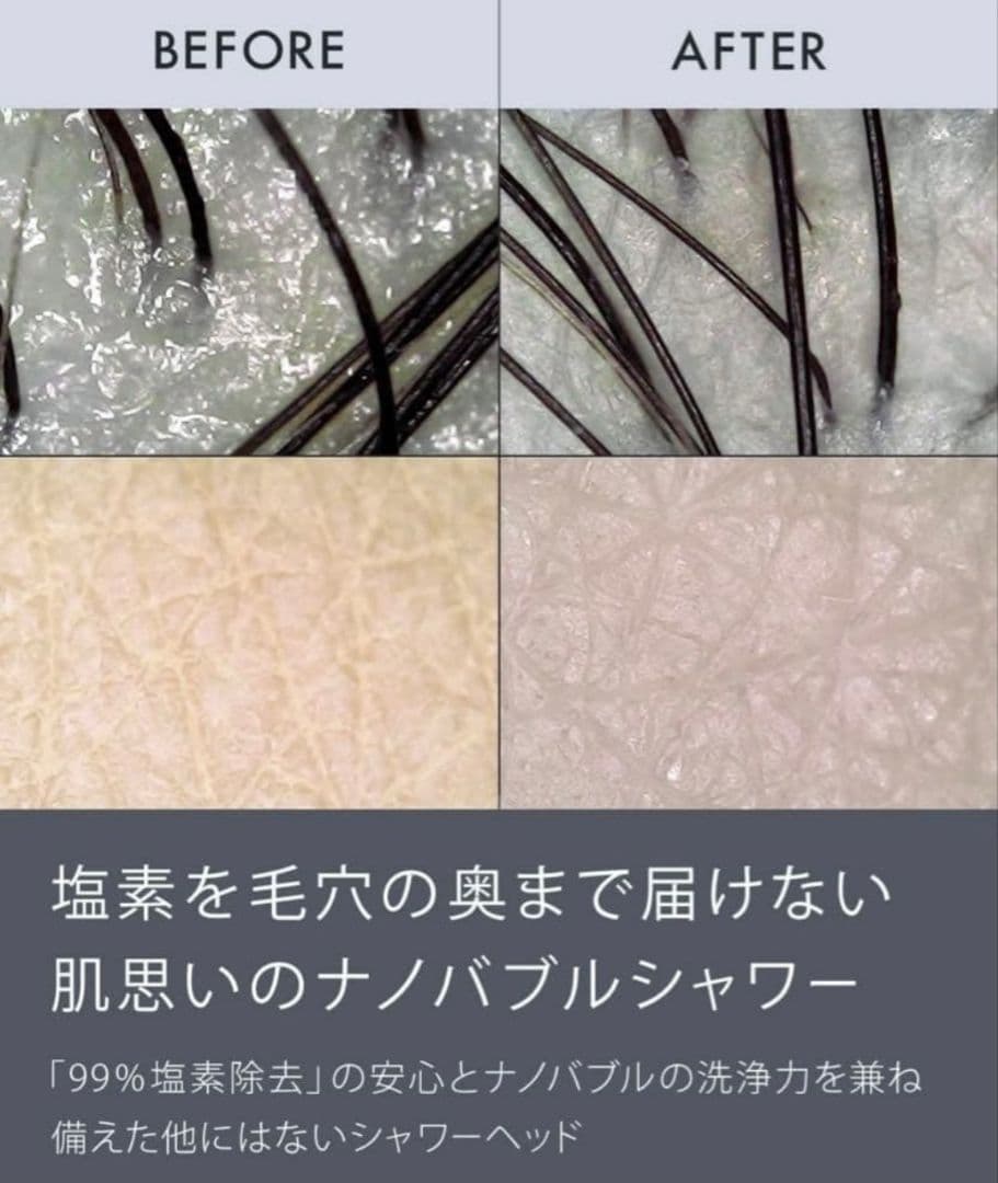 ■Nоendシャワーヘッド■ミスト■ナノバブル76億■節水塩素除去浄水■