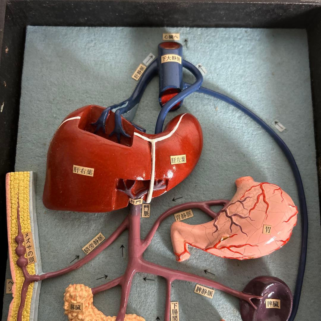 超レア　門脈系模型