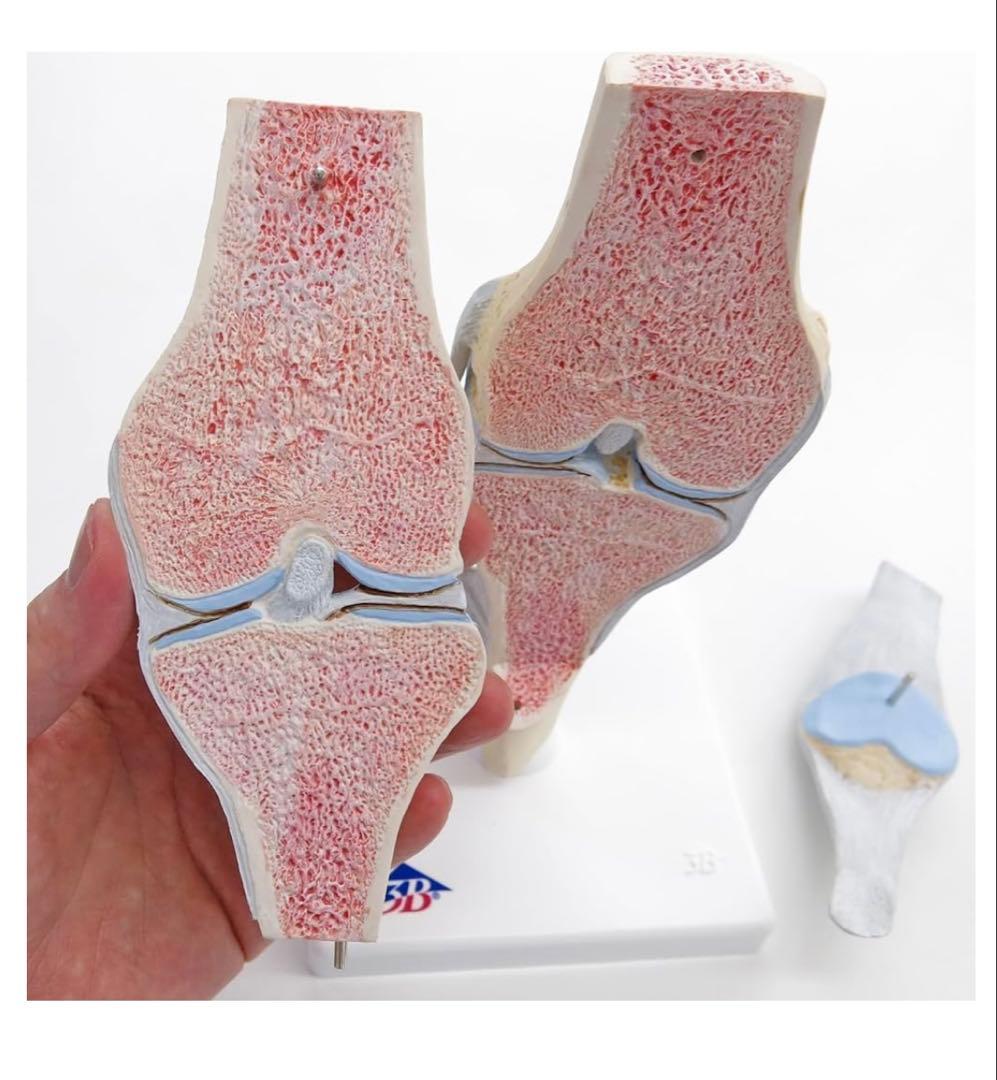 膝関節模型 3B 膝関節断面モデル