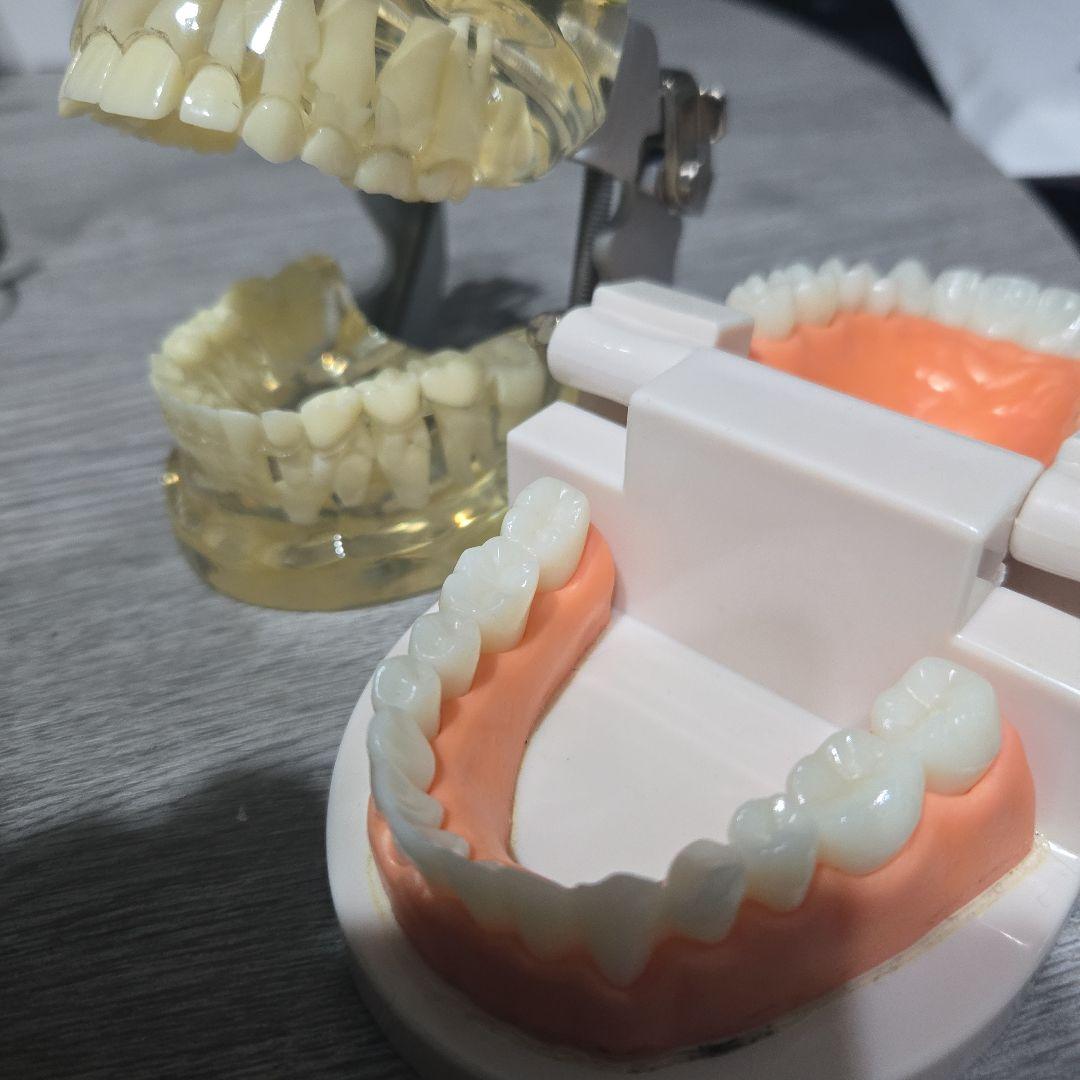 2個 歯列模型 実物大 開閉式 乳歯期 永久歯萌出前 永久歯 交換期 模型 歯科