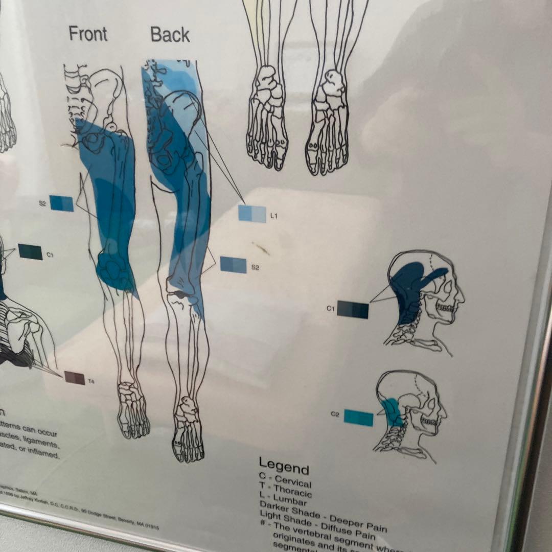 Sclerotome Pain 解剖図！カイロ！整体！鍼灸！エステ！トレーナー！