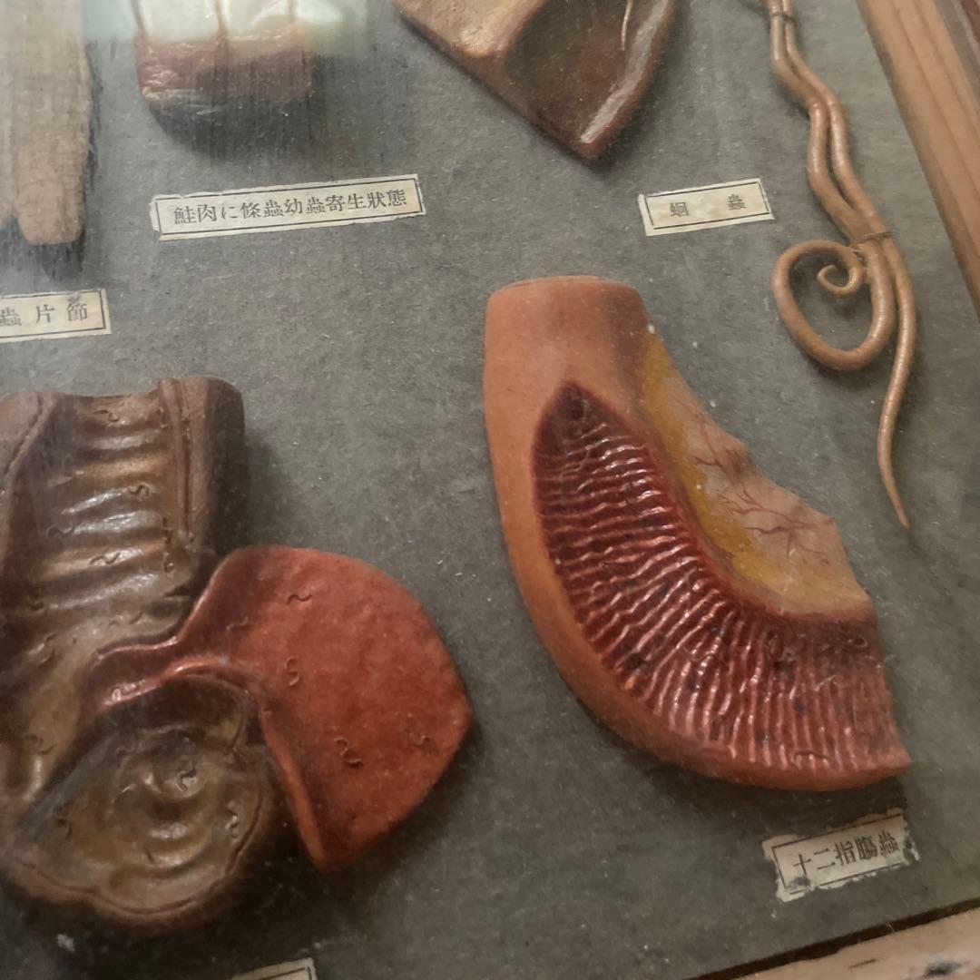 珍品、レトロ　医学模型　寄生虫