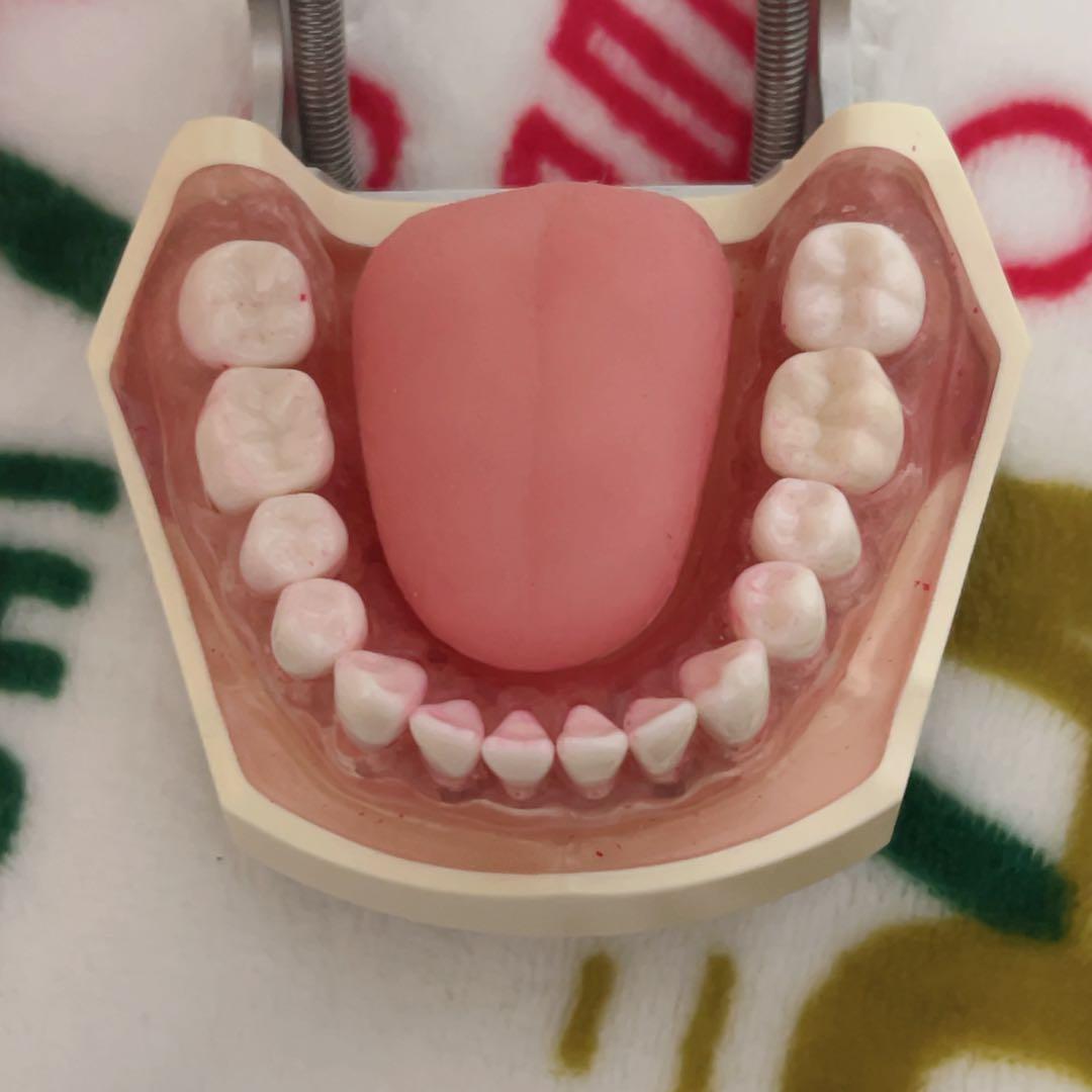 NISSIN 顎模型 歯科衛生士 歯科医師 歯科