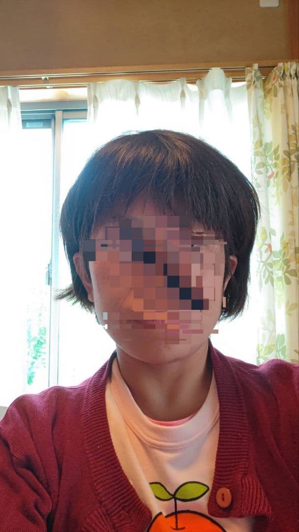 【人毛医療ウィッグ】