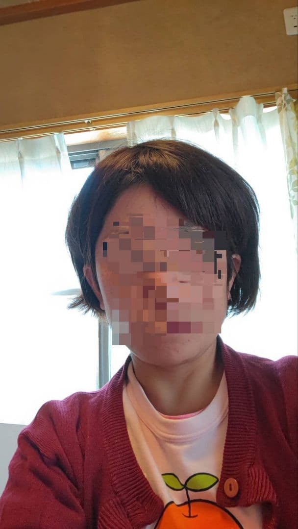 【人毛医療ウィッグ】