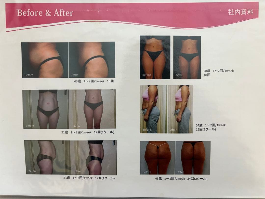 はな ★ 大手エステサロン導入品　業務用　キャビコンパクト