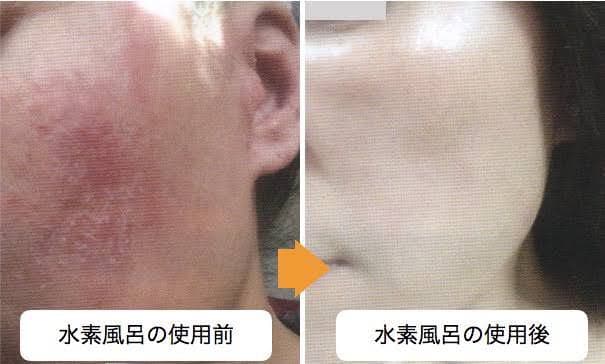 リタライフ 水素バス 水素風呂 【新品・未使用・未開封】