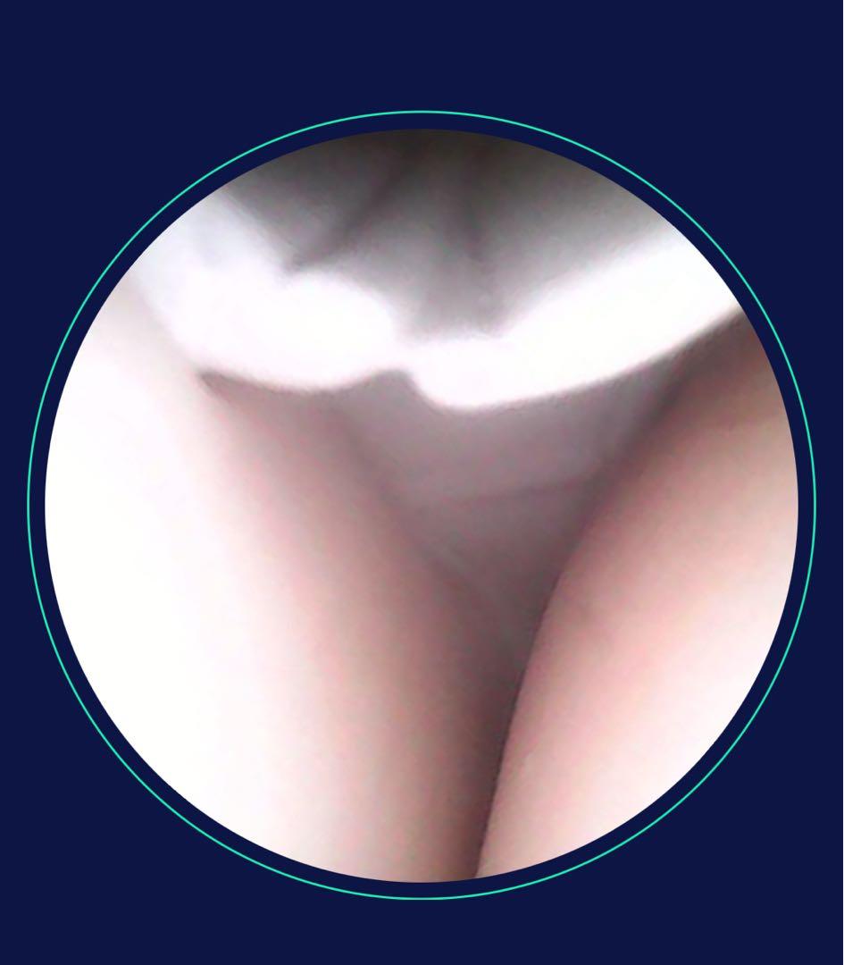 ユミアのアトリエ ユミア・リースフェルト KT MODEL+ 1/7 フィギュア