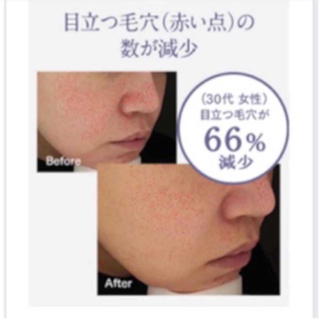 ヤーマン 毛穴ケアスチーマー ブライトクリーン ブラック IS98B