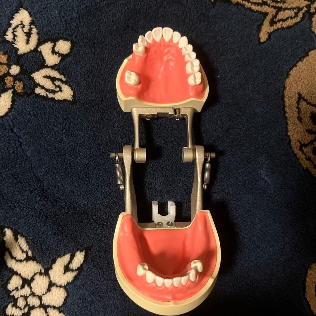 歯牙模型 補綴 歯科 下顎遊離端欠損